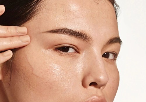 What is the 1 acne treatment?